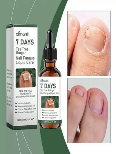 7 DAYS tirnoq zamburug‘iga qarshi shifobaxsh serum — qo‘l va oyoq tirnoqlarini tiklovchi vosita