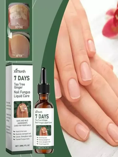 7 DAYS tirnoq zamburug‘iga qarshi shifobaxsh serum — qo‘l va oyoq tirnoqlarini tiklovchi vosita